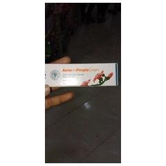 Himalaya Acne n pimple cream product image